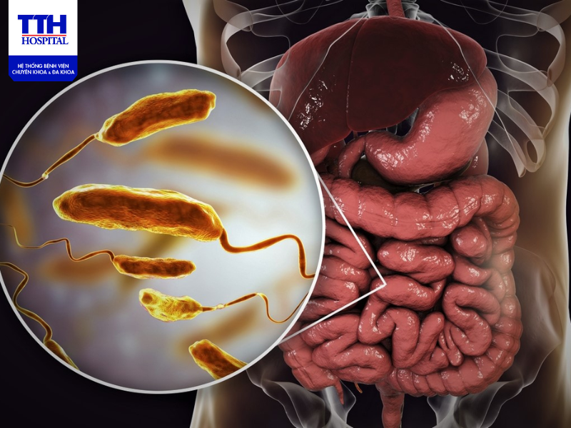 Bệnh tả ở người (Cholerae) là một bệnh truyền nhiễm cấp tính xảy ra ở đường tiêu hoá