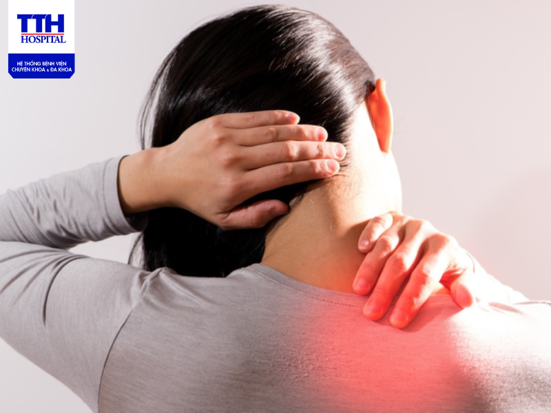 Đau cổ vai gáy là tình trạng co cứng cơ vùng gáy, gây đau nhức, hạn chế tầm vận động khi quay cổ hoặc quay đầu