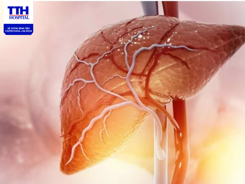 Gan nhiễm mỡ là một bệnh ít biểu hiện triệu chứng nên gây nhiều khó khăn trong việc chẩn đoán bệnh