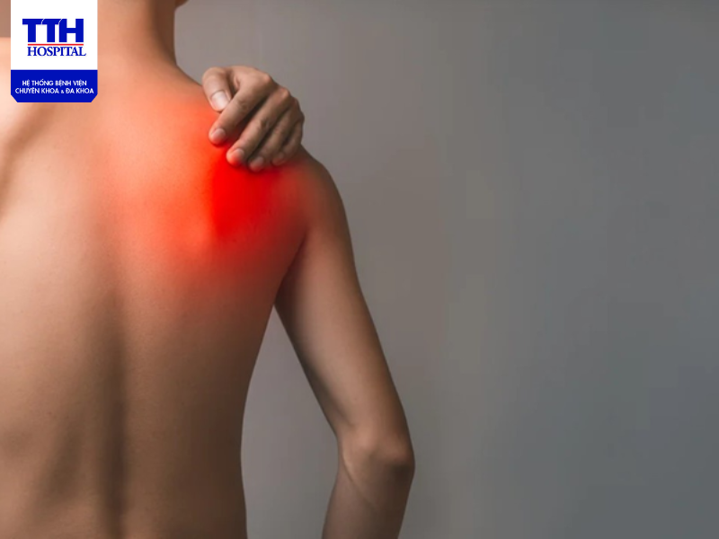 Các phương pháp chẩn đoán đau cổ vai gáy