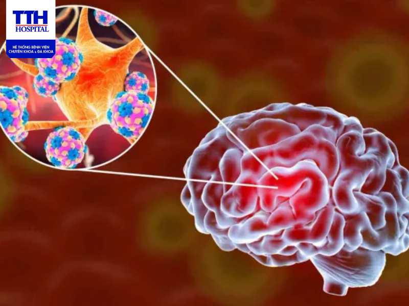 Viêm não Nhật Bản là bệnh truyền nhiễm cấp tính