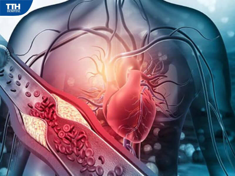 Triệu chứng nhận biết mỡ máu cao ở người cao tuổi