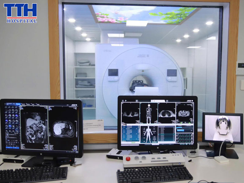 Ưu điểm vượt trội của công nghệ MRI 3.0 Tesla