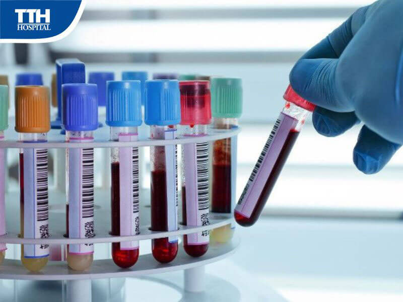 Xét nghiệm tổng quát định kỳ bao gồm những gì?